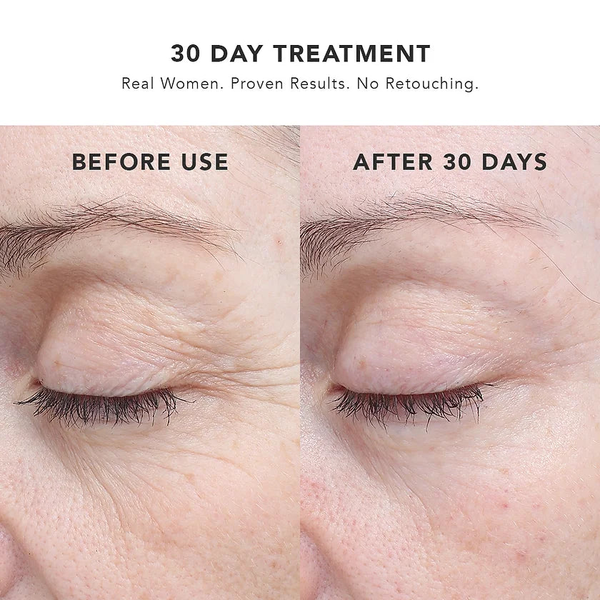 BIOEFFECT 30 Day Treatment -  3x5ml