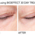 BIOEFFECT 30 Day Treatment -  3x5ml