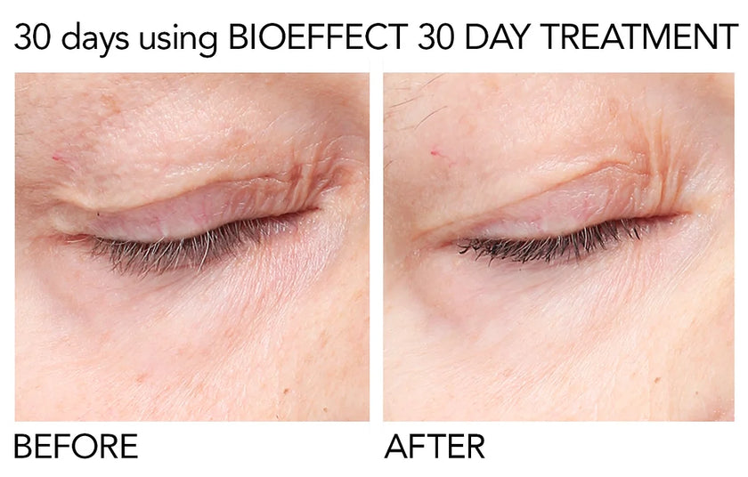 BIOEFFECT 30 Day Treatment -  3x5ml