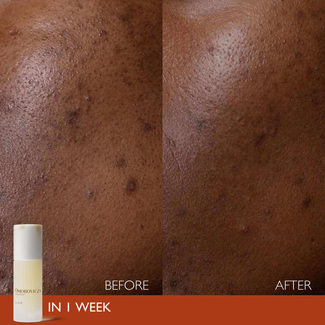 Elixier Serum